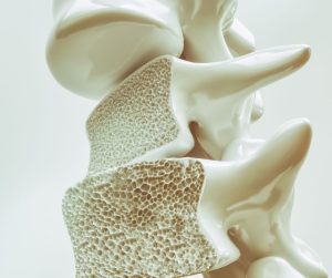 Nedostatok týchto živín môže viesť k oslabeniu kostí a zvýšenému riziku osteoporózy