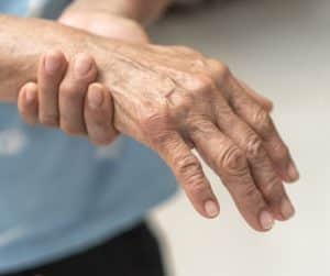 Vitamíny na trpnutie rúk prečo sú dôležité a ako ich získať
