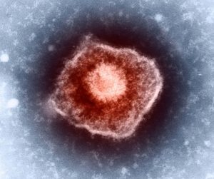 Ovčie kiahne spôsobuje vírus známy ako Varicella Zoster (VZV)